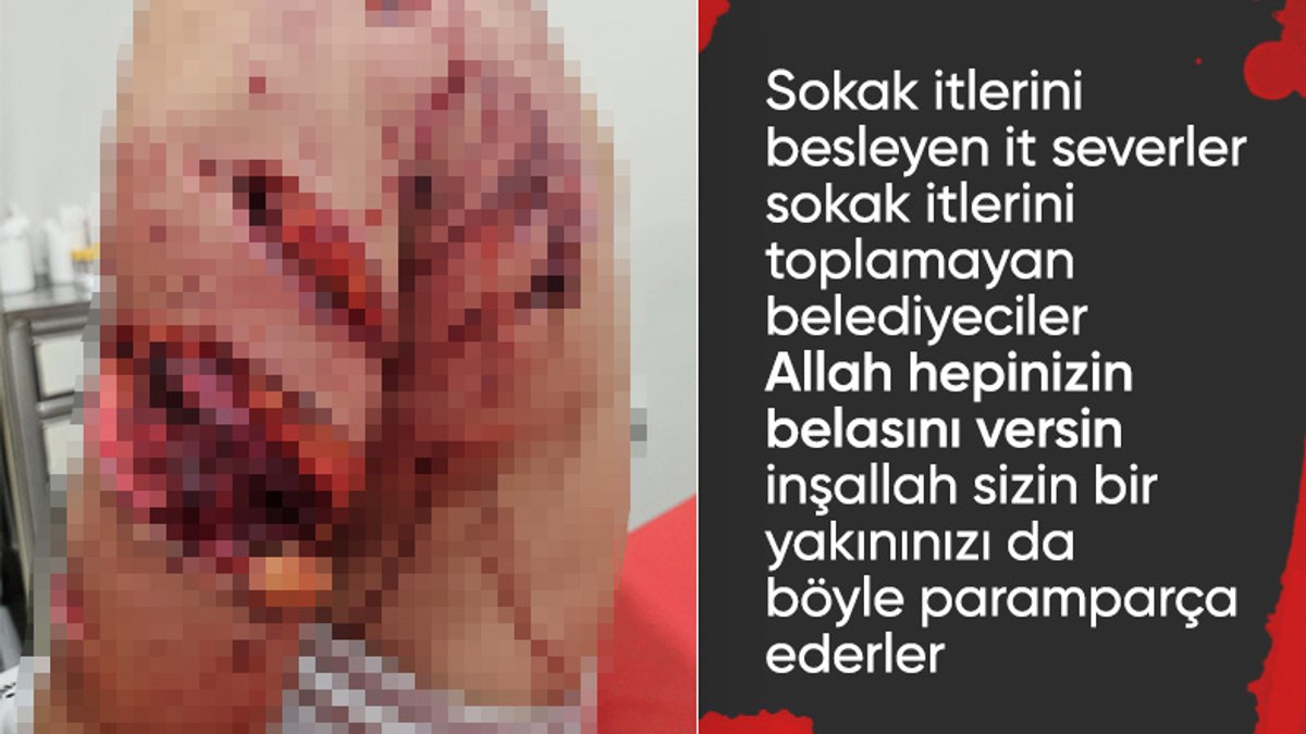 Ankara’da 13 yaşındaki Alperen, sokak köpeklerinin saldırısında yaralandı